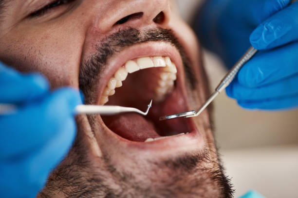 Best Emergency Dental Care for Broken or Chipped Teeth in Chauvin, LA