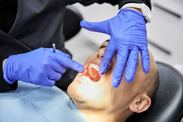 Best Same-Day Emergency Dental Services in Chauvin, LA